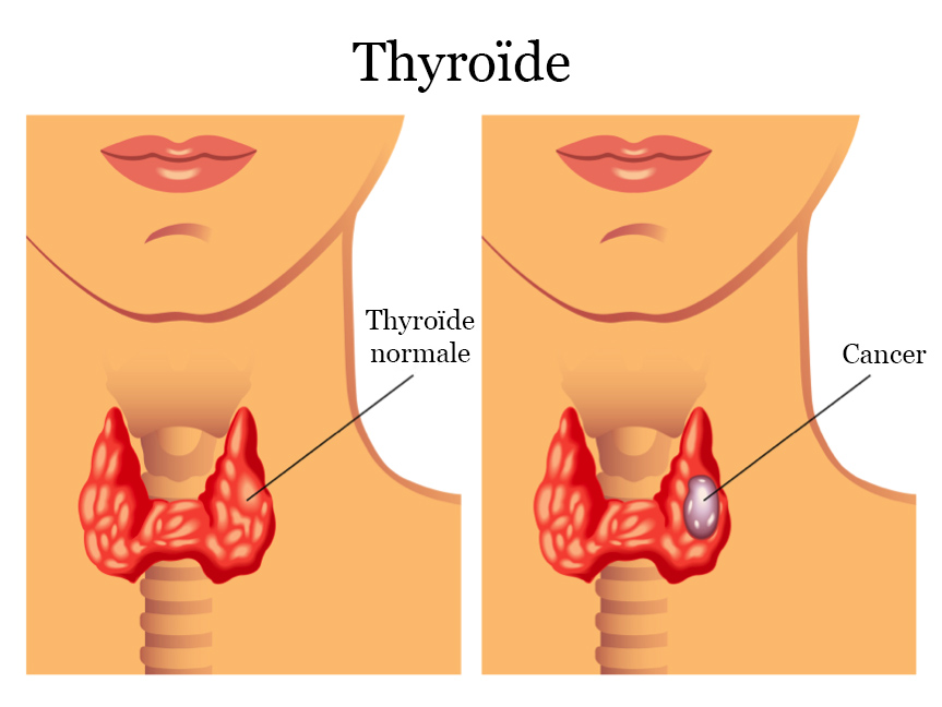 thyro